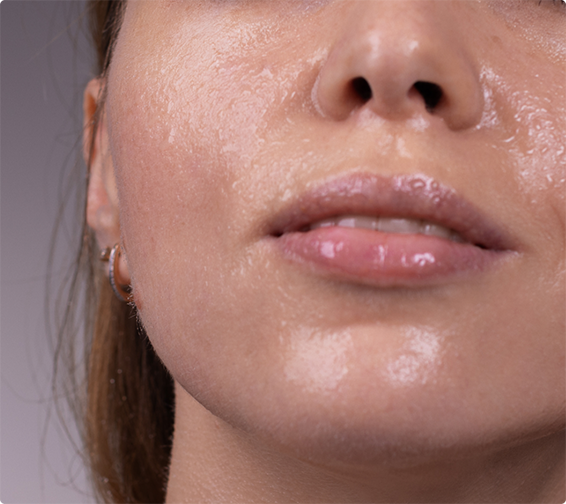 oily skin